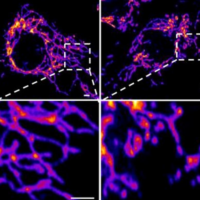 Das hohe Protein des Coronavirus greift das Gefäßsystem auf zellulärer Ebene an

